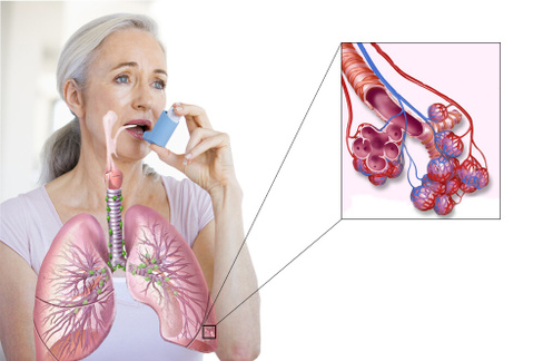 Курсовка Лечение хронических заболеваний бронхов, легких и бронхиальной астмы